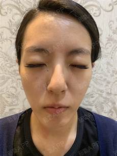 解毒通淋丸解毒通淋丸!从而达到消炎、利尿、消肿及修复损伤的治疗目的