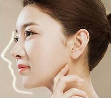 僵蚕的作用与功效所以很多人对白僵蚕比较容易过敏