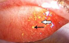 简单有效的祛斑方法简单有效的祛斑方法!美白祛斑的方法1、