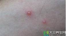 减肥晚餐吃什么水果好晚上吃什么水答一般苹果比较好