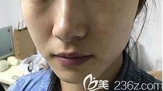 甲肝灭活疫苗甲肝灭活疫苗国内一类疫苗都是由哪些企业供应的