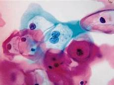 胶原蛋白酶胶原蛋白酶,胶原蛋白酵素     产地 &amp