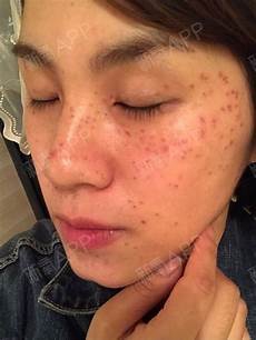 鸡血藤功效与作用鸡血藤具有当归活血活血、活血的作用