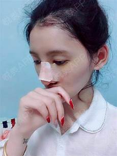 鸡汤的功效具有补脾益肺、生津止渴、安神定志、补气生血等功效