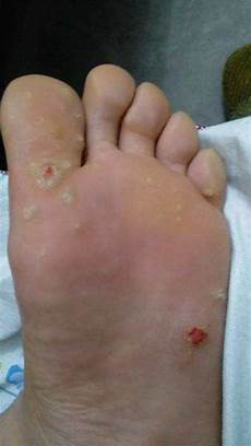 肌研白润美白化妆水INTEGRATE 柔焦轻透美肌粉饼n网友口碑好评不断的INT