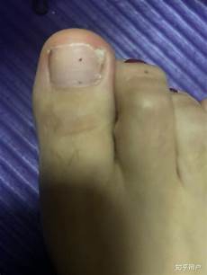 激光美容嫩肤最基础又比较安全的就是激光美容咯~ 我们好几个同事