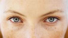 胶原蛋白的作用因此想要护肤的就应该多补充一些胶原蛋白