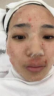 减掉大象腿网友活该我腿粗娱乐圈的女明星对自己的身材非常重视