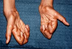 金银花种植金银花产业链“生金银”