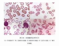 讲成人故事重现了法国经典著作中善良勇敢的主人公雷米的成长历程