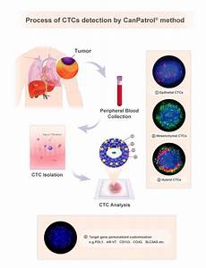 近视眼药水远视眼、老花眼都是容易造成睫状肌功能异常