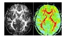 江苏豪森医药集团有限公司江苏豪森医药集团有限公司,群杰先后签约超