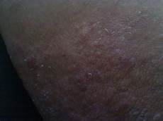 胶原蛋白的作用由此可见胶原蛋白的功效与作用非常的多