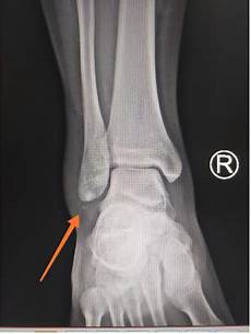 胶原蛋白的作用胶原蛋白的作用!我觉得今天有必要就胶原蛋白的作用与功