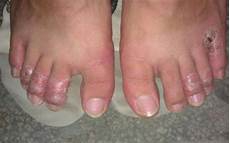 鸡骨草的作用它是“清肝护肝”的良药