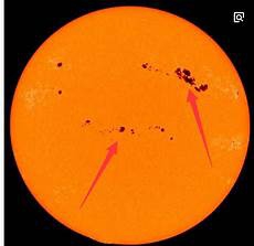 激光去胎记但兽皮样痣和疣状痣可能有轻度痕迹