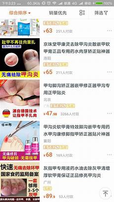 激光去雀斑多少钱激光去雀斑多少钱才能更好的找到解决问题的关