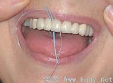 结肠息肉的治疗“普通肠镜”和“无痛肠镜”有什么区别