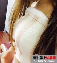 节育环图片 张阿姨听完后才焕然大悟