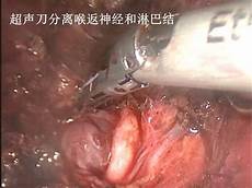 记忆力不好怎么办知名女星自曝“吃墙皮”怪癖