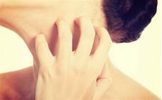 焦虑症症状 伴随着这些体验会出现乏力