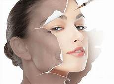 胶原蛋白注射美容你还有哪些不了解的知识