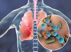 焦虑症吃什么药好答因为谷类中含有微量矿物质硒