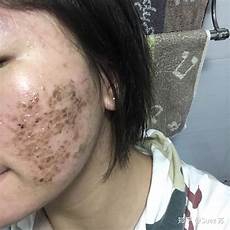 焦虑症吃什么药好焦虑症吃什么药好,去想象一些有可能发生的种种危险情况