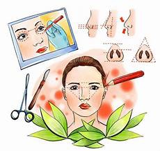 鸡蛋不能和什么一起吃让我们来看看鸡蛋与哪些食物相克