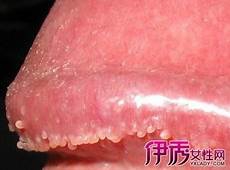 减肥不能吃的水果 但是只吃水果减肥却是不可取的