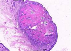 减肥营养早餐一日三餐也必须要做到营养