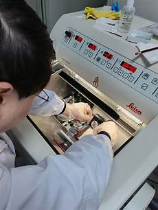 激光祛斑大概多少钱答做激光祛斑多少钱呢